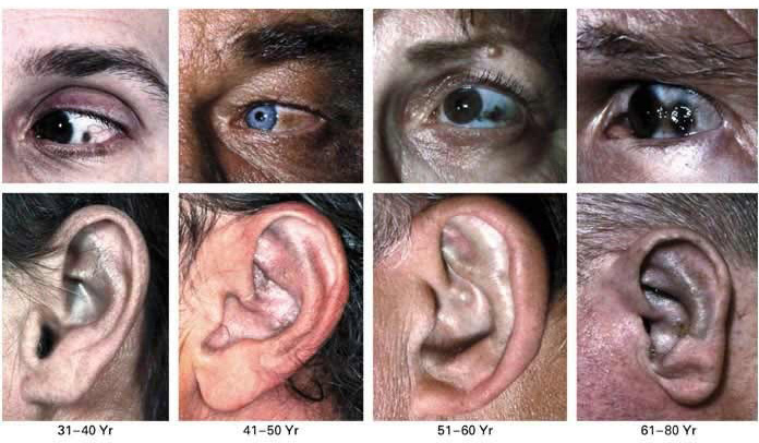 Types of diseases, rare diseases